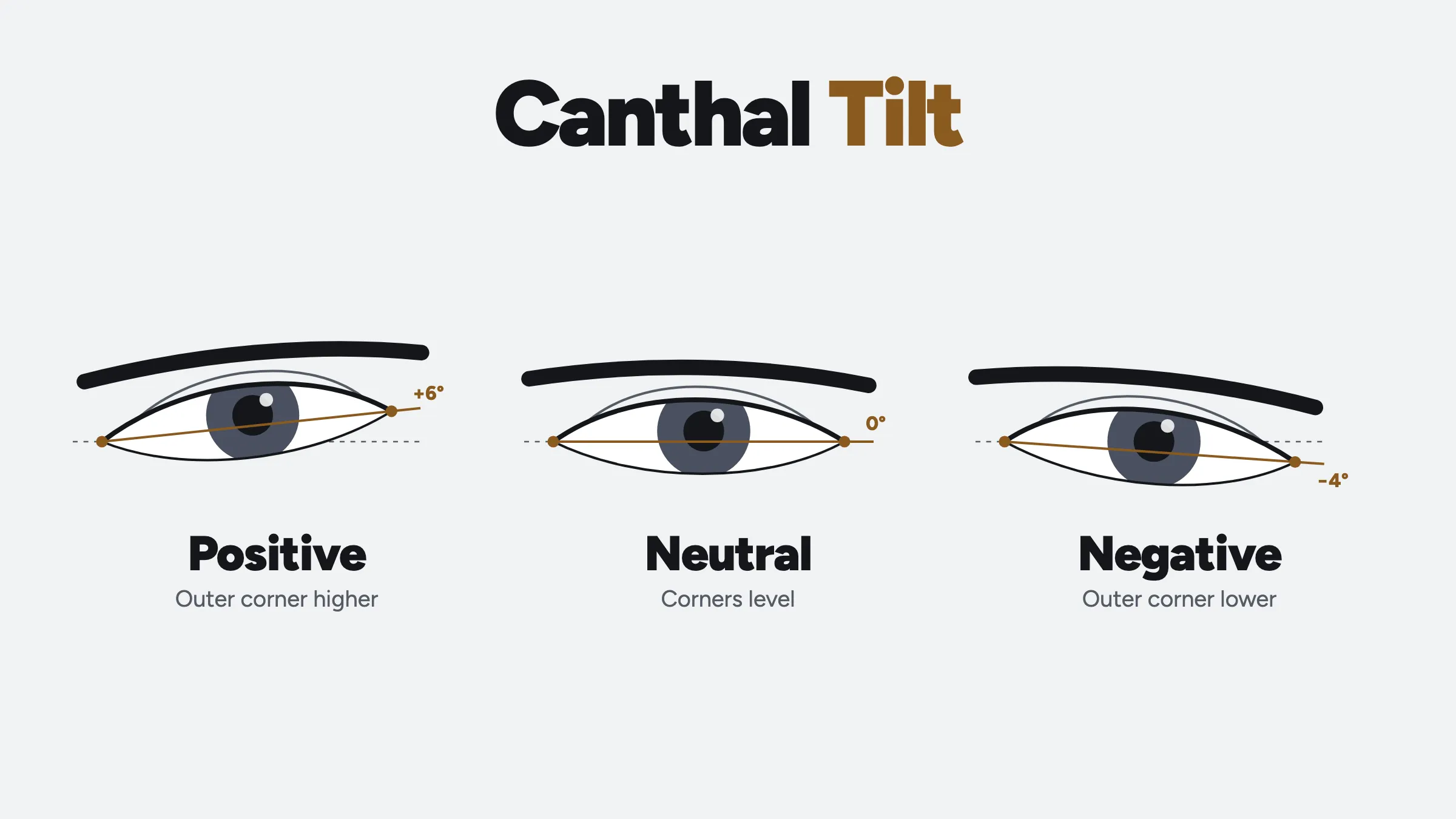 Diagram of three eyes: a positive canthal tilt with the outer corner 6 degrees higher than the inner one, a neutral tilt with level corners, and a negative tilt with the outer corner 4 degrees lower.