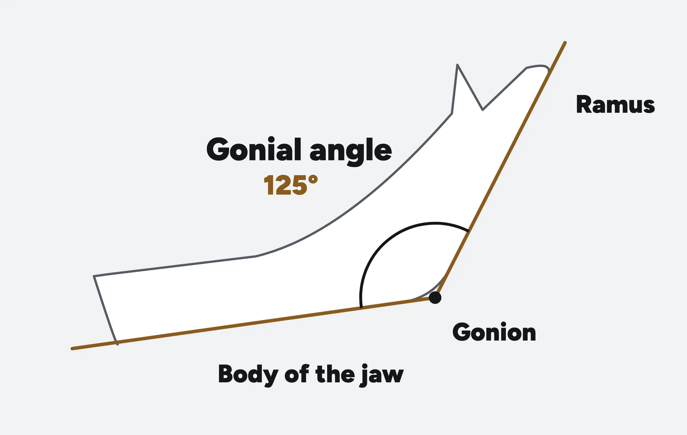 Labelled diagram of the lower jaw from the side: one line runs along the back edge of the ramus, another along the lower border of the jaw body, and they meet at the gonion at 125 degrees.