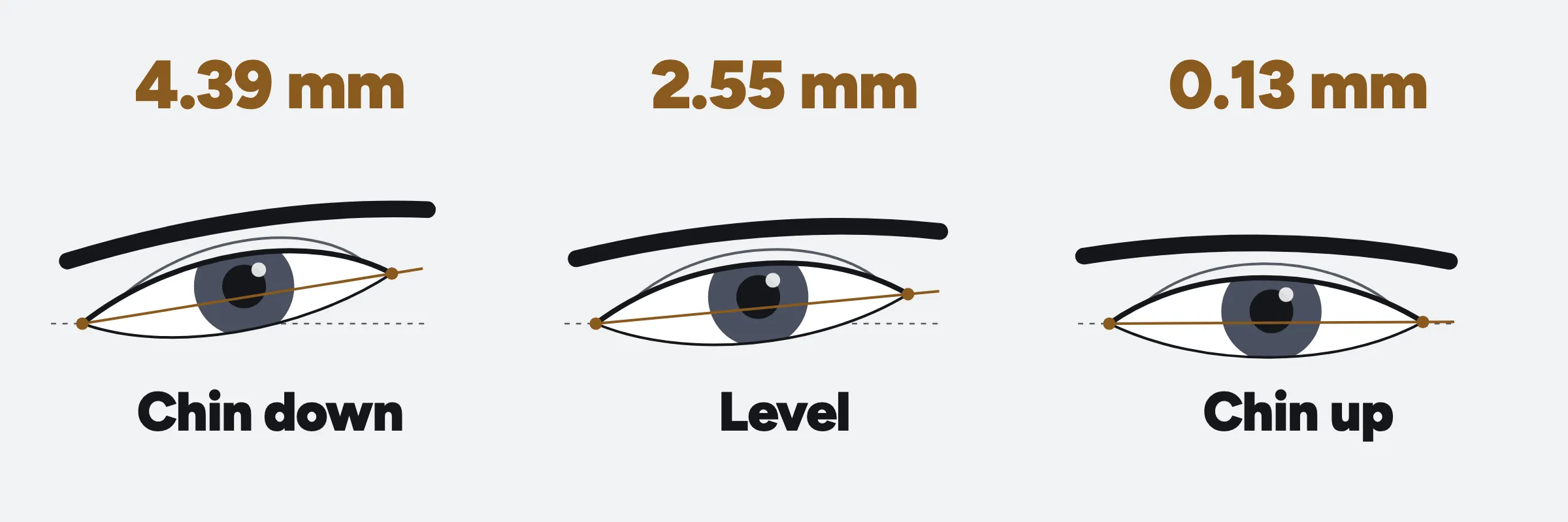 Diagram of one eye three ways, labelled with how far the outer corner sits above the inner one: 4.39 mm with the chin down, 2.55 mm level, 0.13 mm with the chin up.