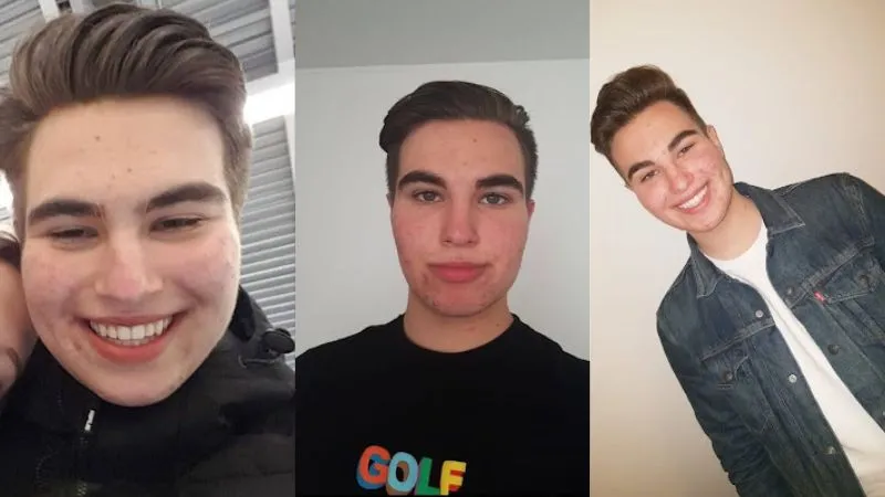 Larsanova early photos before his looksmaxxing journey showing starting appearance