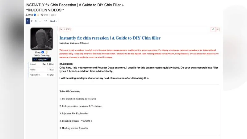 Orka's forum guide to DIY chin filler with injection videos.