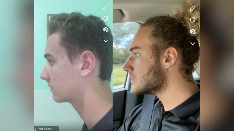 ZyzzReincarnate side profile comparison before and after looksmaxxing journey