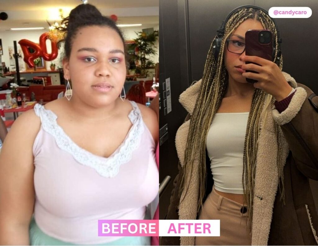 Looksmaxxing Before & After 3