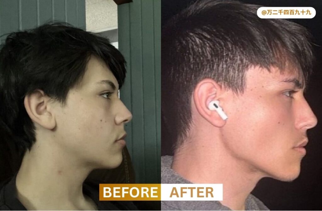 Looksmaxxing Before and After 4